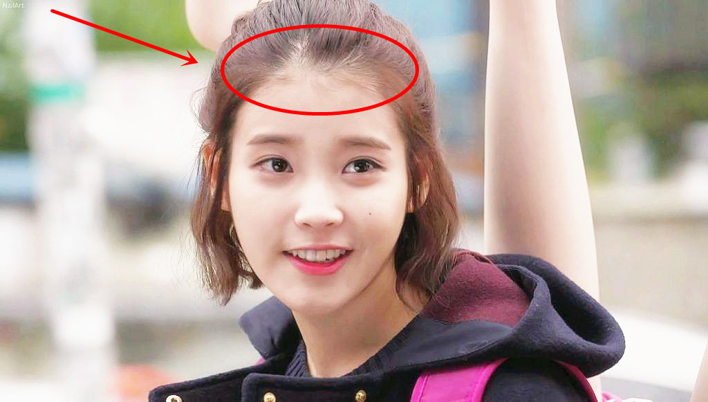 童颜|“童颜脸”都有这5点，你脸上有几个？