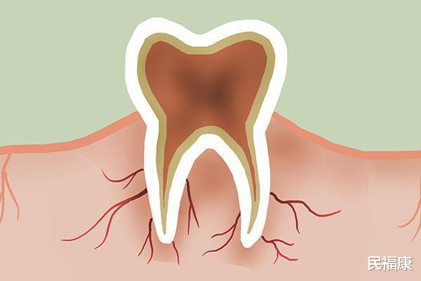 「牙齿」牙缝抠出脏物,又软又臭,是什么东西?送你土方法,拥有一口好牙