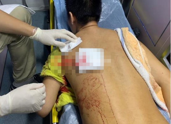 「杭州」亲戚投靠自己，男子帮其找工作补贴3000元，遭亲戚用刀砍：钱太少了