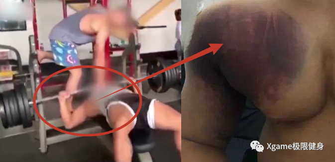 「胸肌」一张图告诉你，卧推胸肌撕裂到底多恐怖！