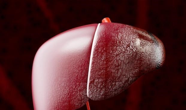 肝脏|晨起有4个异常，八成是肝硬化降临前兆，一个没有，可以偷着乐