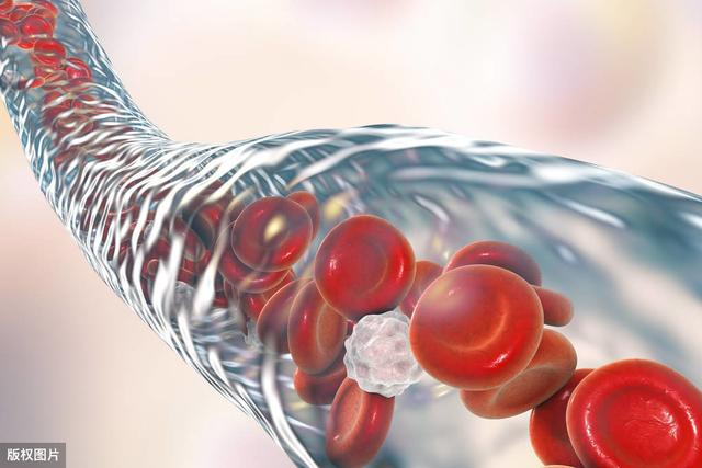 @血管不好，常吃3物，做好3事，改掉三个坏习惯，给你的血管减龄