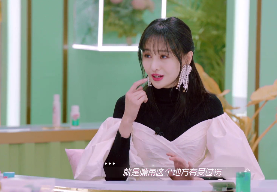 [郑爽]郑爽说出自己嘴角疤痕原因，她的回答让戚薇愣一跳，听着都嫌疼
