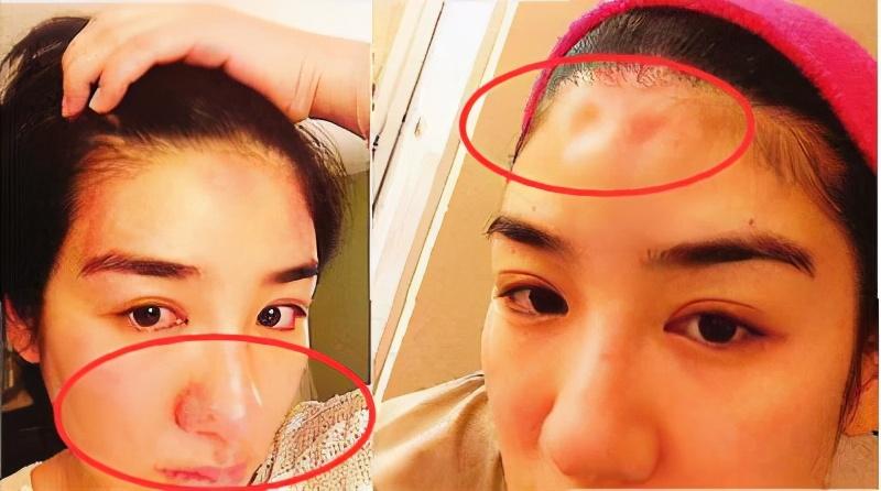 娱乐圈|她是“最惨女星”，被富豪男友按在地上猛打到失忆，法庭上发抖