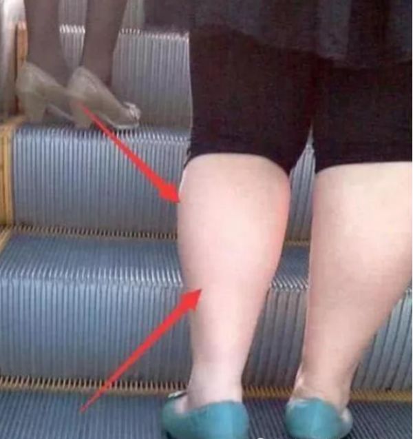 空腹|早上空腹“禁止”吃3物，相当于喝油，怪不得“大象腿”不离不弃