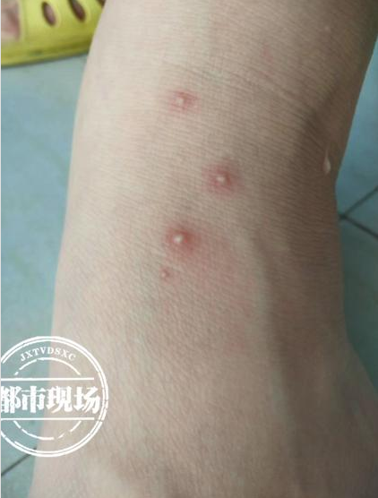 江南都市报|紧急提醒!江西有多人被它咬,千万别碰