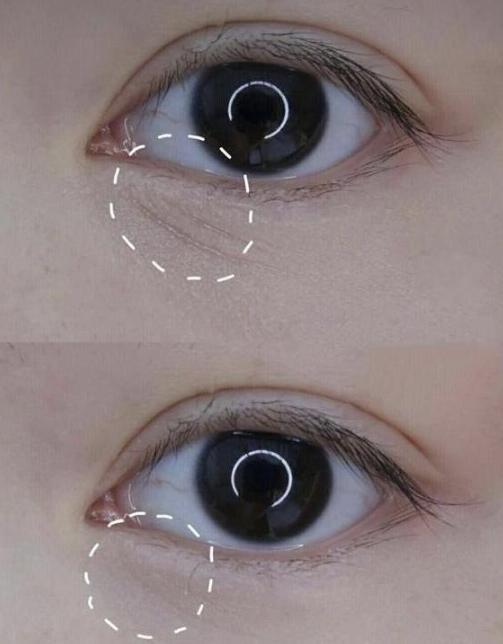 「眼霜」戚薇力荐的“续命”眼霜，用后黑眼圈细纹都没了，李佳琦：平价兰蔻！