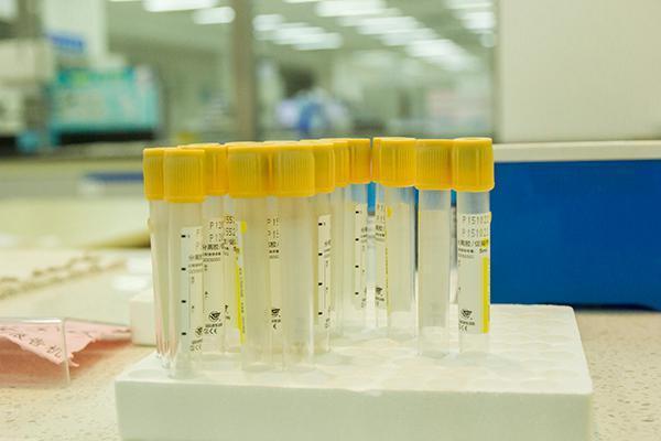 肝脏|肝病专家:体检单上2个数值出现异常,可能会得肝癌,需要警惕