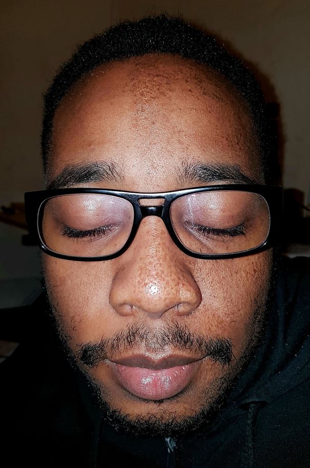 |全球已经有25个人,分享了遗传的差异,这些人天生拥有独特的器官