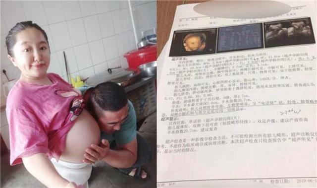 小志的历史观点|当年身高90厘米袖珍女孩，不听医生劝阻生下一子，后来怎样了？