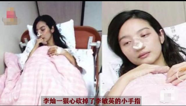 李敏英|悲惨的李敏英：新婚13天被家暴断指，终身不孕，被丈夫毁了一生
