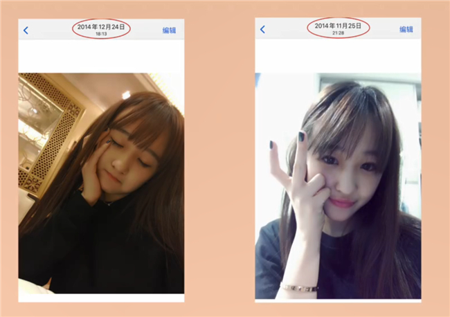 Uzi|Uzi女友自曝整容前后照片,这天价鼻子效果绝了!网友:有钱任性