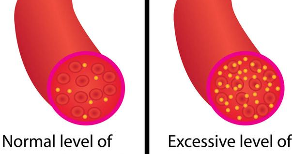 糖尿病|60后夫妻，吃素两年，双双糖尿病离世，医生：只因一种东西吃太多