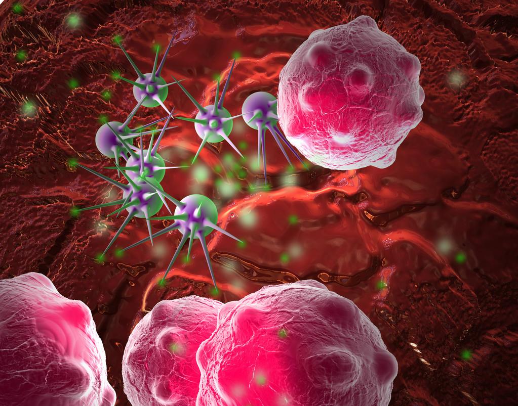 [癌细胞]医生强调：放屁时若有“这种感觉”，或是癌细胞想“蠢蠢欲动”