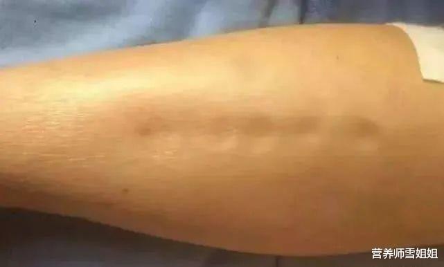 睡眠▲肾好不好，看这四处，强健肾脏，牢记“三勤，三忌”