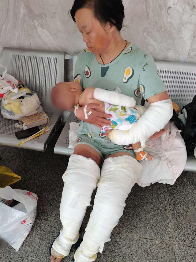 李岩|一家三口被烧伤，妻儿放弃治疗只求救丈夫，儿子才六个月