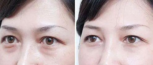 面膜：20岁不用抗衰老？女明星们的“冻龄秘籍”——膜派小金罐修护面膜