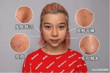 肝脏|28岁女子，身上长出“小红点”，医生：再来晚一点，小命不保