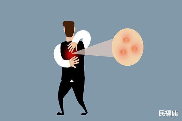 []头皮、后背总是长疙瘩，是怎么回事？别不在意，也可能与疾病有关