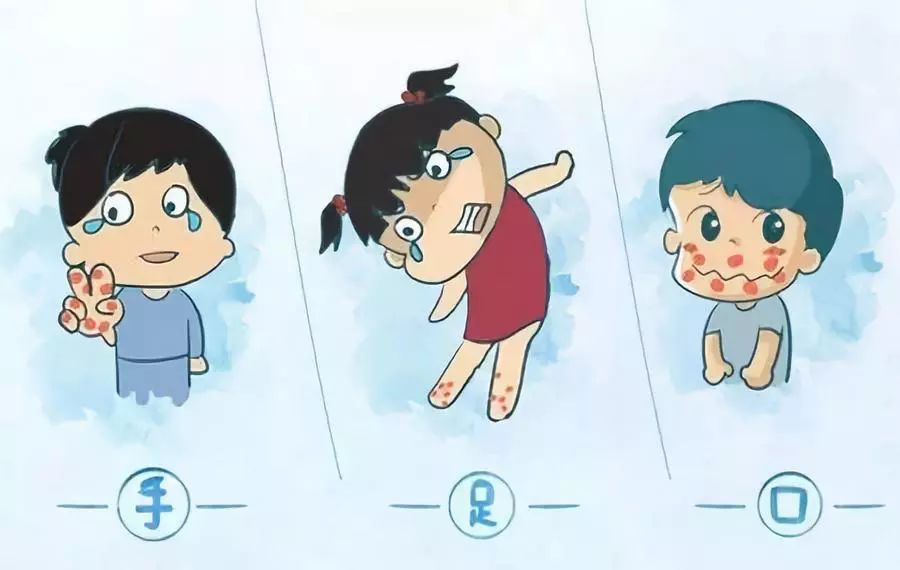 手足口病：紧急！严防！临沂疾控：这个病进入高发状态！