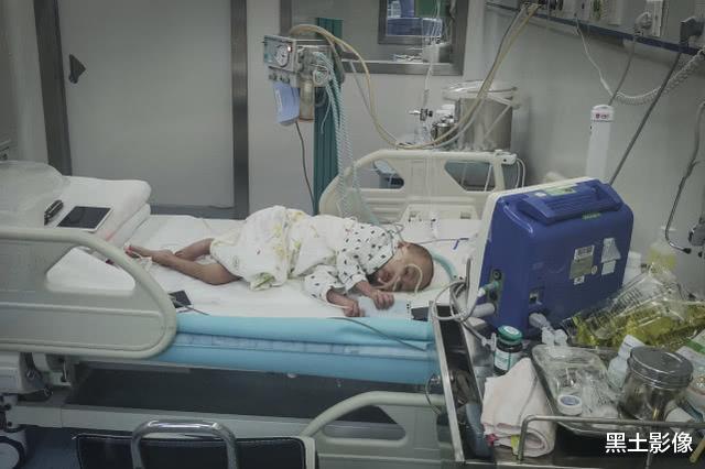 骨髓移植：河南一5岁男童被医生禁食6个月仅剩28斤，靠24小时输营养液保命