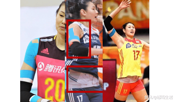 「女排」女排有多难？惠若琪7根钢钉不敢退，朱婷回乡却连家门都进不去