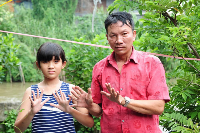 睹图|男子共有24根手指和脚趾比常人多4个，称走路更稳干活更方便