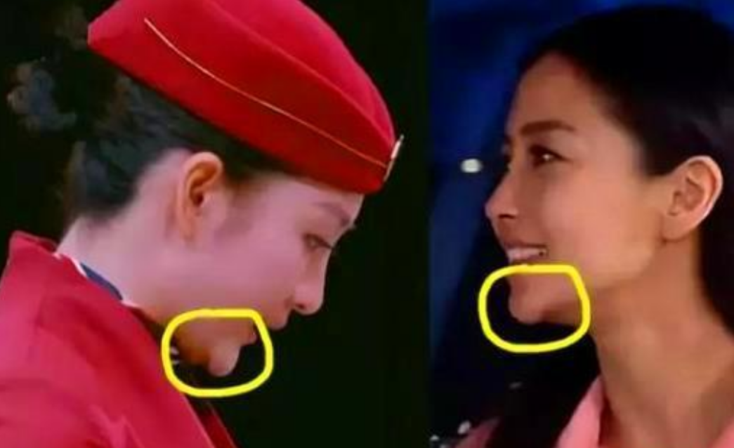 #王鸥#脸部歪曲变形，发际线后移，下巴假体飞出，她现在的“芒果脸”一言难尽