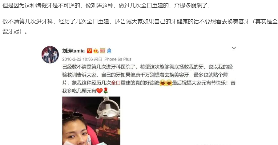 牙科|明星再瞎整烤瓷牙，就会变成封面上的马，哈哈哈哈！