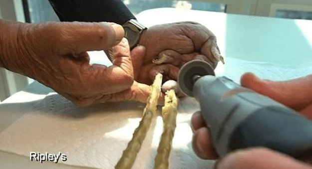 印度老人將指甲留44年，剪掉捐博物館後，他的手指產生瞭大變化-圖4