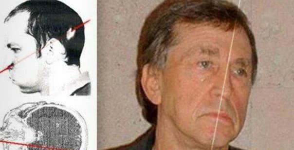 #粒子加速器#当年他把头伸进了粒子加速器中,被高能的质子束直接爆头,后来怎样?