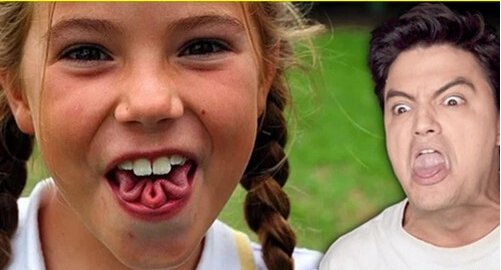 |在这个世界上，只有极少数人才拥有的9大罕见身体特征！