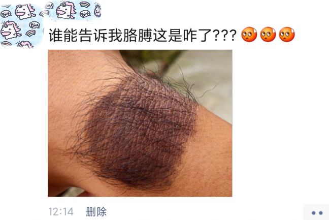 |“谁能告诉我胳膊这是咋了？”哈哈哈说返祖现象是认真的吗...