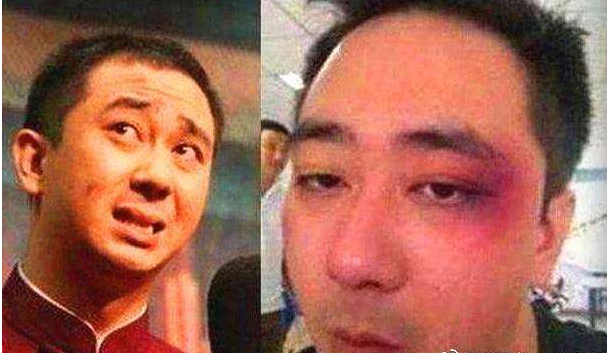 『张若昀』王自健：从前李诞喊我“王哥”，现在他红了，喊我“自健”