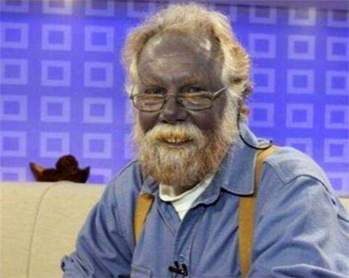 |世界唯一的“蓝精灵家族”：隐居6000米高山上，100年后才被人发现