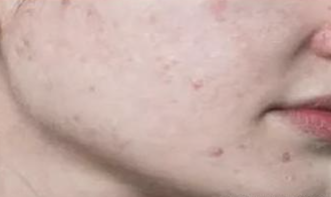 明星|明星特写是“照妖镜”？女星未修图下颜值不再，底妆斑驳卡粉严重