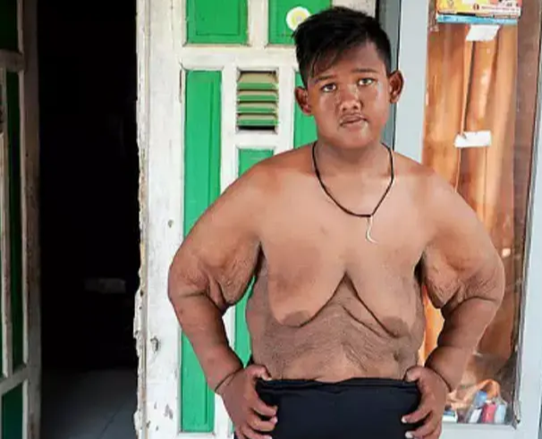 『』那个被叫“最胖”的400斤男孩,减肥后全身是赘肉,如今怎样