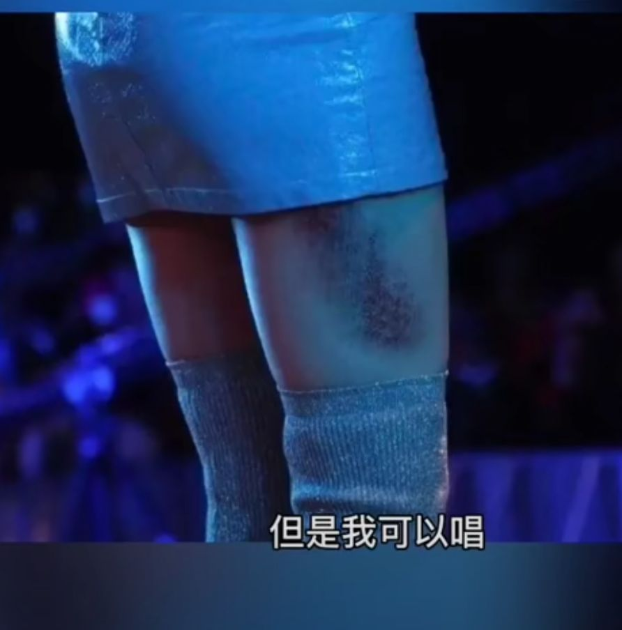 黄龄|黄龄音乐节摔倒，哭着道歉，仍坚持唱歌，承办方：风沙太大？？？