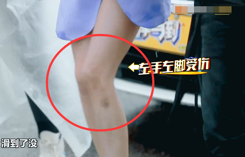 滤镜|综艺节目的滤镜有多厚，看到吴宣仪的伤口，观众：真当我傻