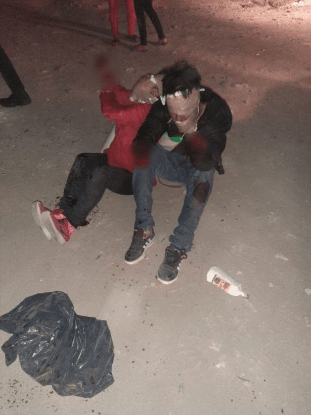 墨西哥兩男一女被黑幫蒙眼砍斷雙手扔路邊，脖子掛著罪狀失聲尖叫-圖2