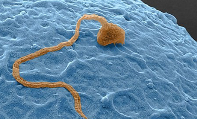 基因@基因具有差异性？科学家：中国人与非洲人的基因有较大差异