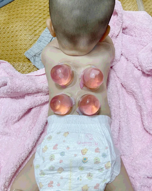 「肾病」“医生说消肿才给拔，半夜起来我就给拔了”结果评论区炸锅了哈哈哈