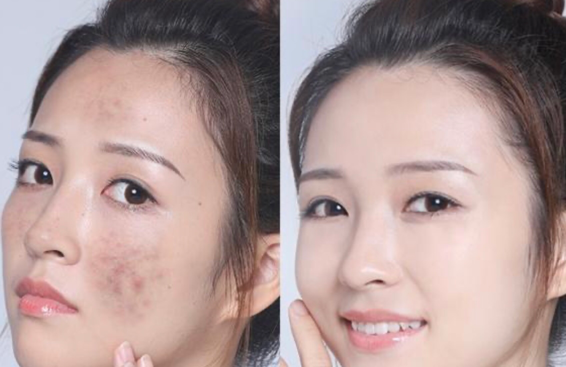 洗面奶|被禁用的烂脸洗面奶，还有很多人再买，医生哭笑不得：还不如清水