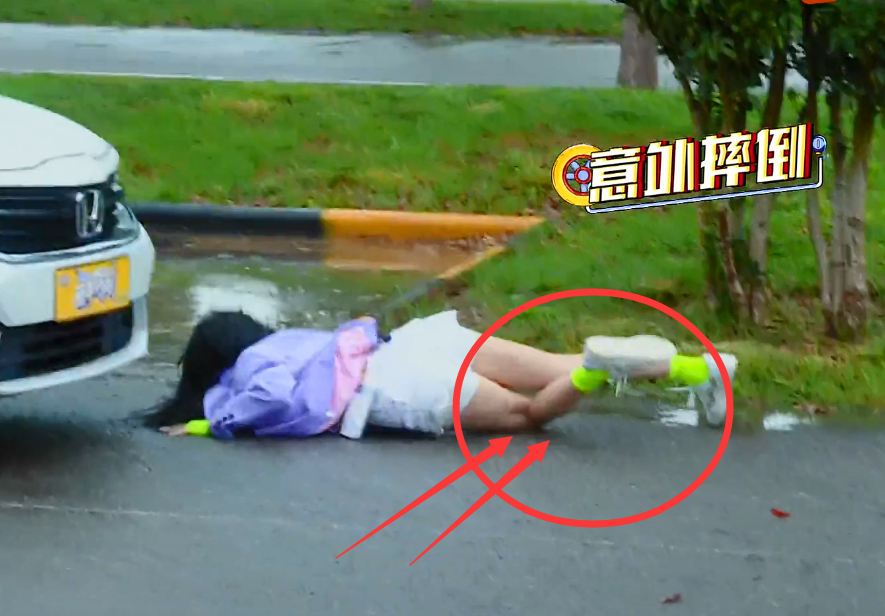 滤镜|综艺节目的滤镜有多厚，看到吴宣仪的伤口，观众：真当我傻