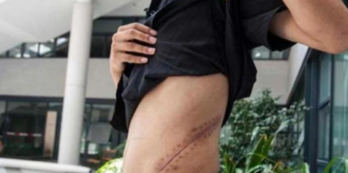 苹果|还记得10年前,用一个肾换苹果4手机的17岁高中生吗?后来如何