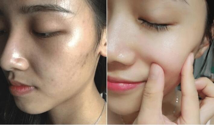护肤|建议女生：使用精华液时要远离这2个误区，免得效果不佳还伤肤