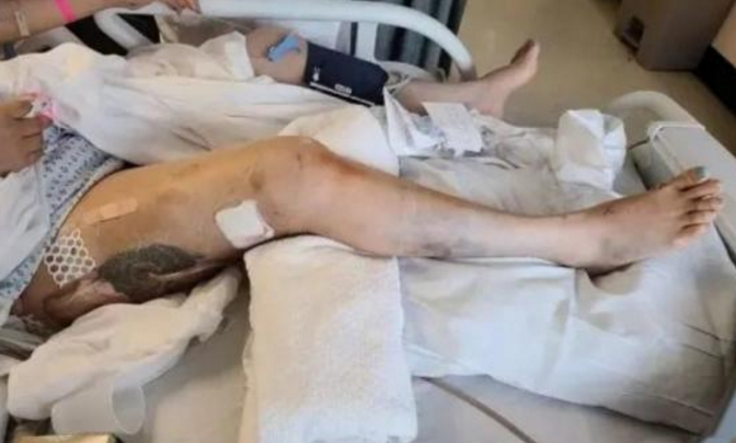 美国@华裔女孩被示威黑人殴打，路人冷漠观看，黄种人在美国现状