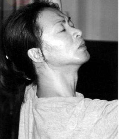 金星|?金星当年做手术前领导苦心劝导，多年后才知其良苦用心