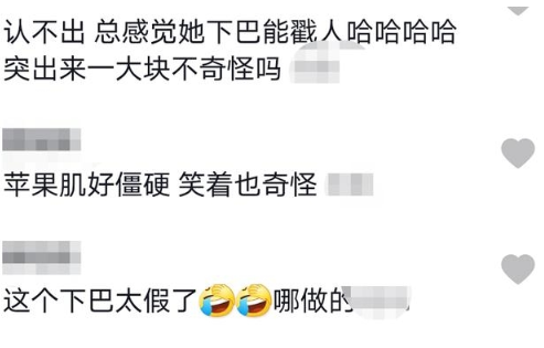 王小玮|玖月奇迹王小玮大变脸！下巴拔尖苹果肌僵硬，二婚嫁歌手当董事长