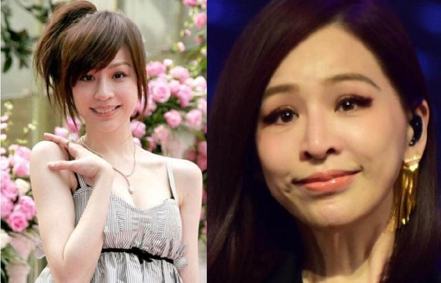 【整容】被玻尿酸毁了的六大女星,王心凌像老太太,而她丑到不能接受
